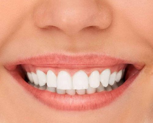 Best Dental Clinic And Dentists in Mohali 3B2 - Stunning Smilez