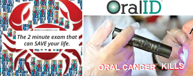 Oral ID